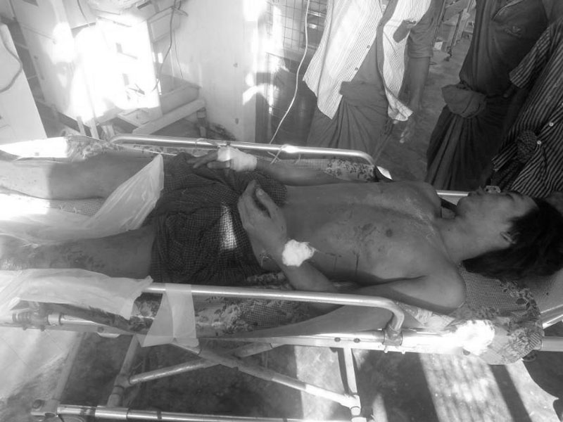  Maung Kein Paw was injured in a landmine explosion on December 3. (Photo: CJ)
